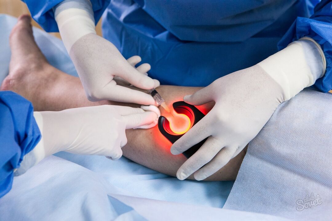 Diagnostics of varicose veins in the legs