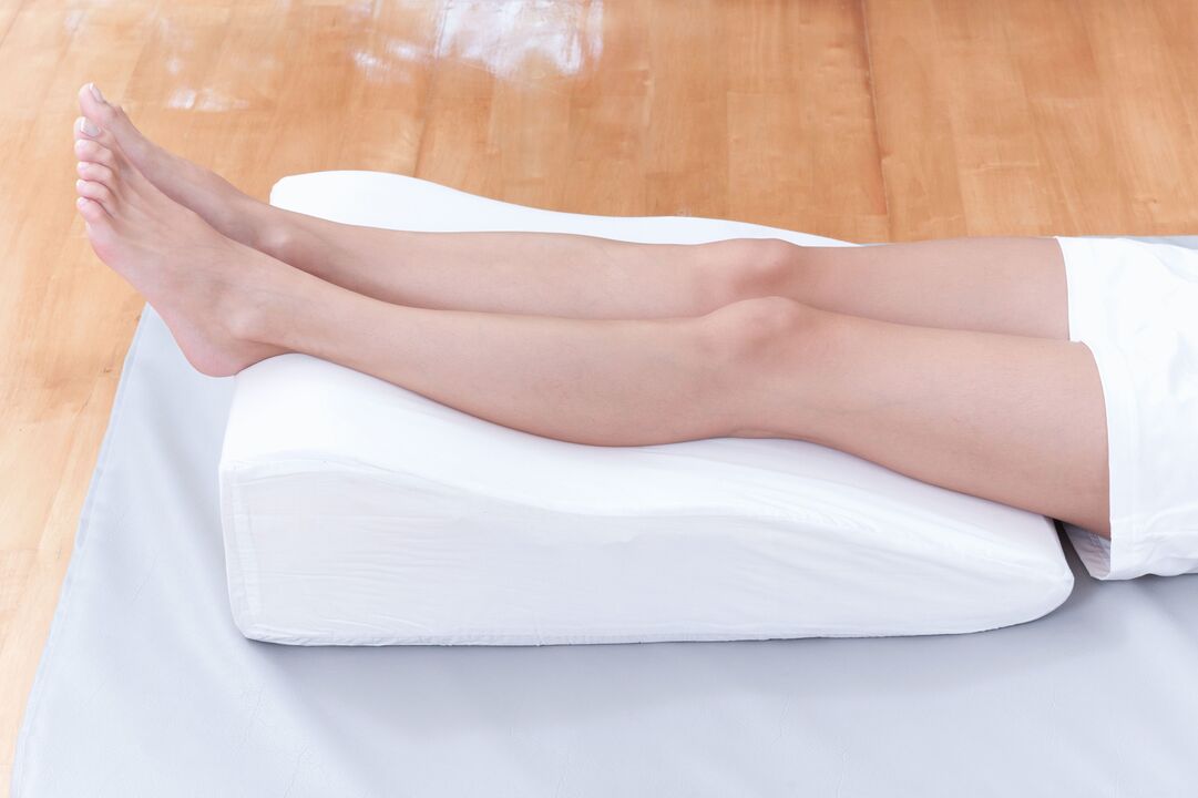 Prevention of varicose veins
