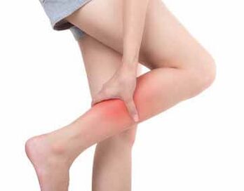 Symptoms of varicose veins