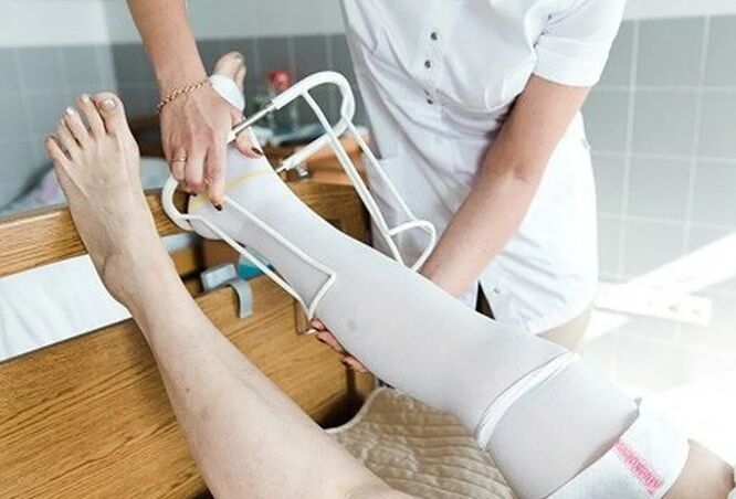 The period after surgery in the veins of legs